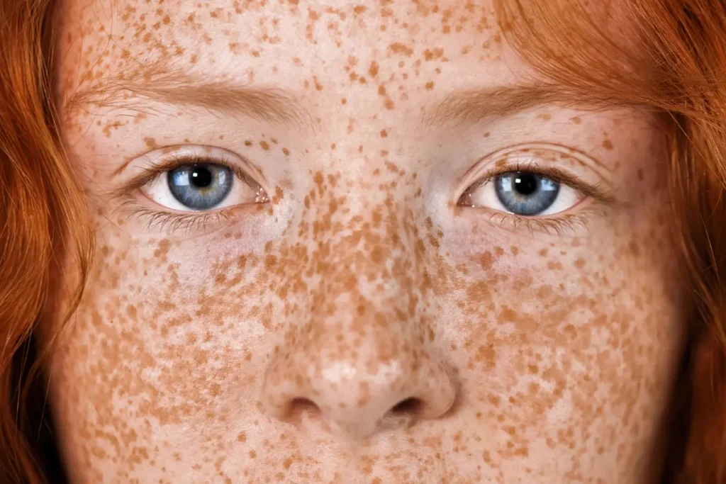 pleiadian starseed birthmarks